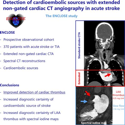 Detection of Cardioembolic Sources With Nongated Cardiac Computed ...