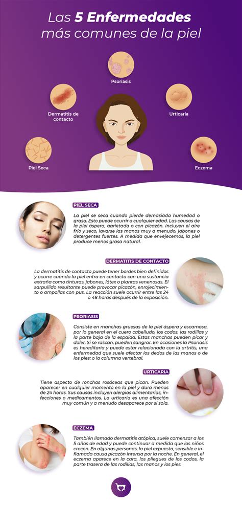 ¿Cómo reconocer las afecciones comunes de la piel? - Pattymart
