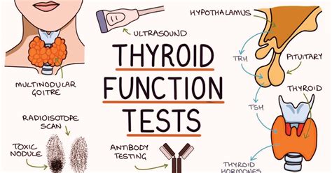 The Thyroid Test: What is a thyroid test? How to treat it? Information ...