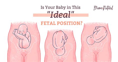 Fetal Position Transverse Baby Position: Causes And Safe Delivery