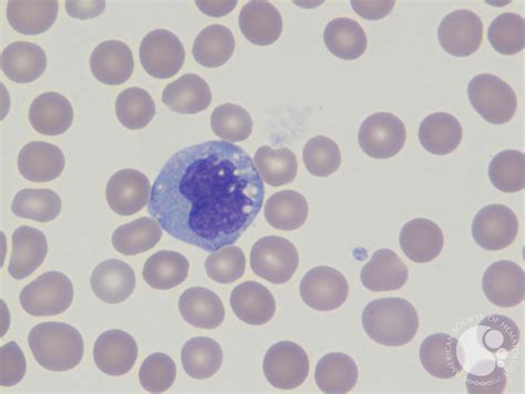 Image result for Monocyte