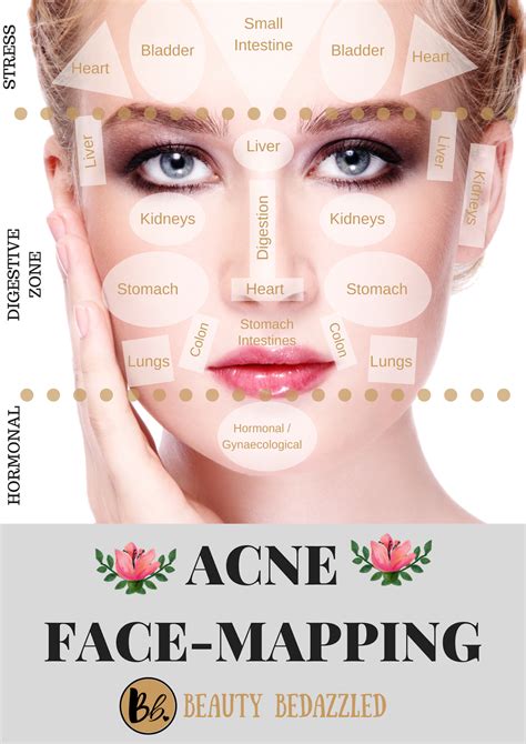 Acne Face Mapping - What does Your Acne Tell YOU? in 2024 | Face mapping acne, Face acne, Face ...