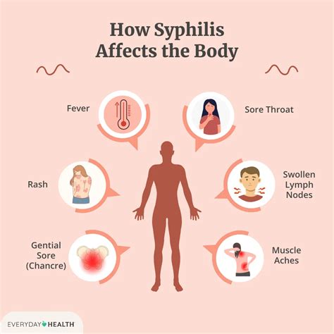 Syphilis In Men Cure