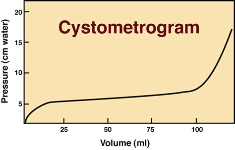 Image result for Videocystometrogram Procedure