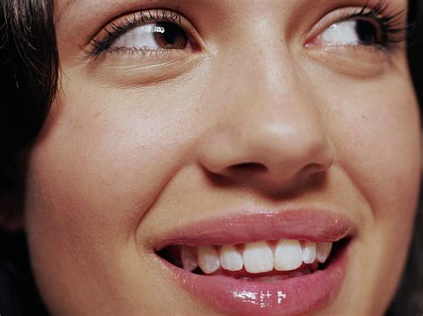 Image result for Pimple From Dry Lips