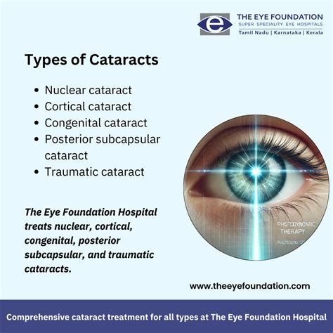 Are there different types of cataracts?