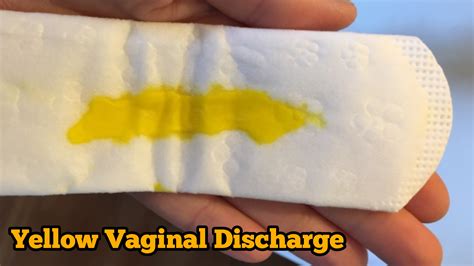 Is Crusty Discharge Normal at Tyson Walsh blog