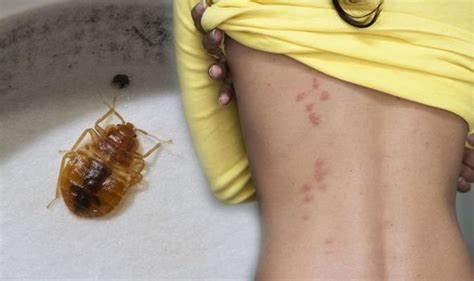 Bed bugs: Signs you may have been bitten and how to get rid of an ...