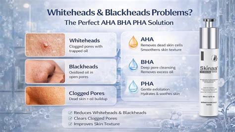 Whiteheads & Blackheads Problems? Here’s the Perfect AHA BHA Solution ...
