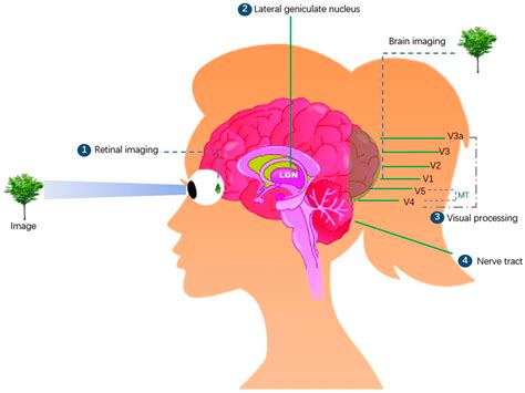 Image result for Top Bionic Technology