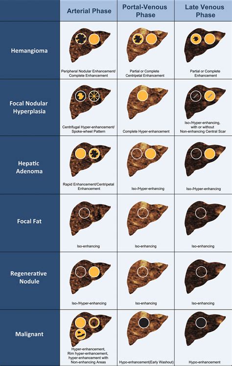 Contrast-enhanced US Assessment of Focal Liver Lesions in ...