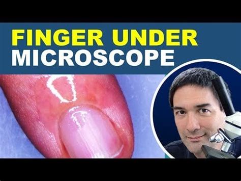 Image result for Finger Under Microscope
