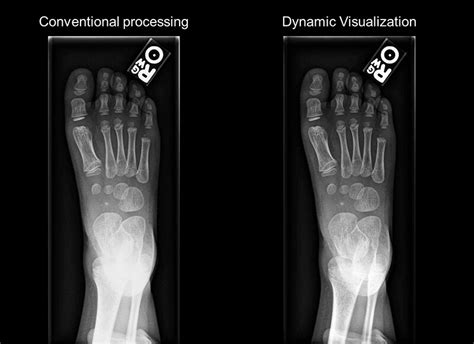 Image result for Fuji Dynamic Visualization