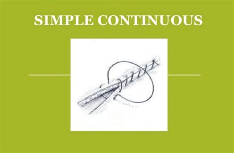 Image result for Continuous Suture Patterns