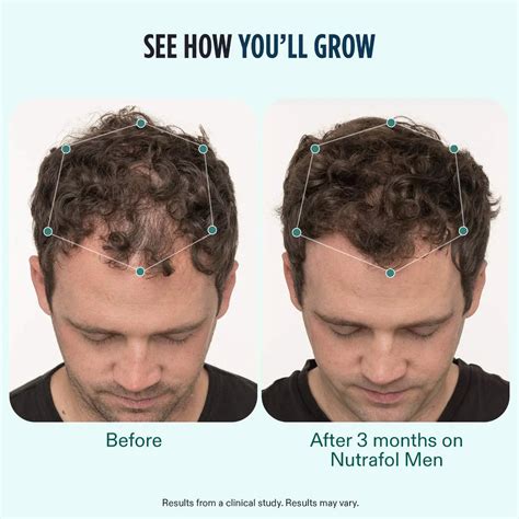 Nutrafol Men (3 Month Supply) | Advanced Hair Growth Supplement for Men ...
