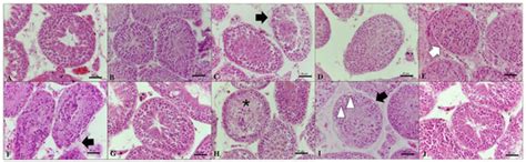 Cryopreservation of Testicular Tissue from Adult Red-Rumped Agoutis ...