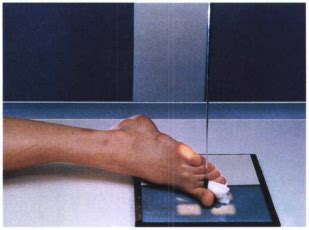 Image result for Toe Lateral View