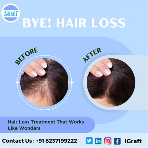 Can Hair Loss Be Reversed? Effective Treatments & Solutions