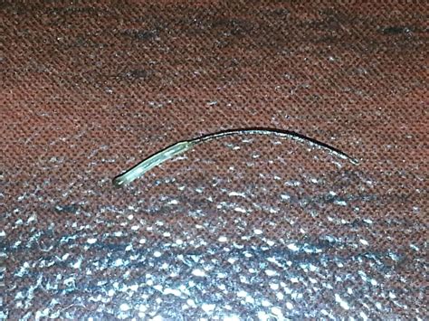 Hair follicle | Hair pulling, Hair follicle, Infected hair follicle