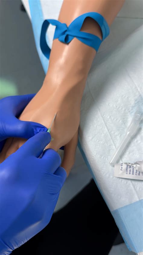 Image result for Fishtail Lab Values