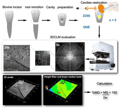 The Influence of Adhesive Strategy, Type of Dental Composite, and ...