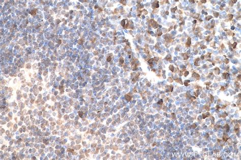 IHCeasy CAPG Ready-To-Use IHC Kit KHC0709 | Proteintech