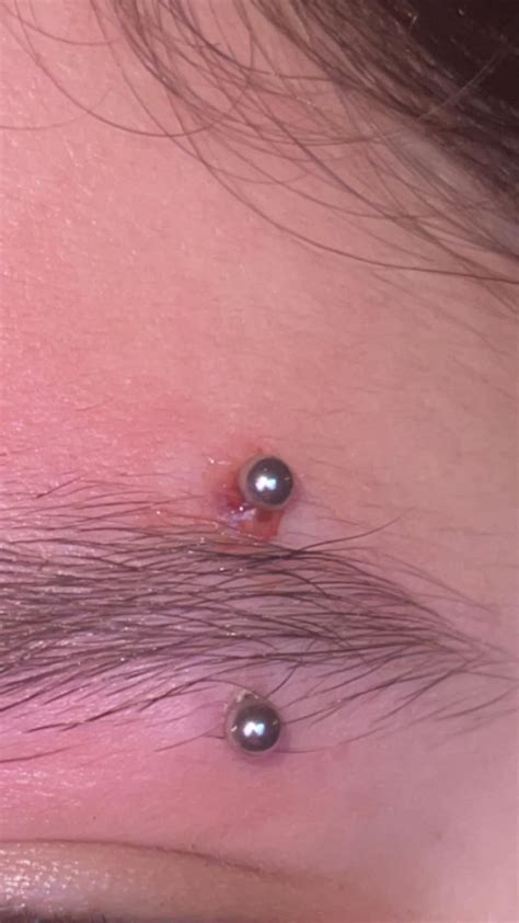 Eyebrow piercing infected? : r/PiercingAdvice