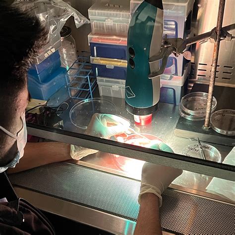 Image result for Apr Resection Surgery