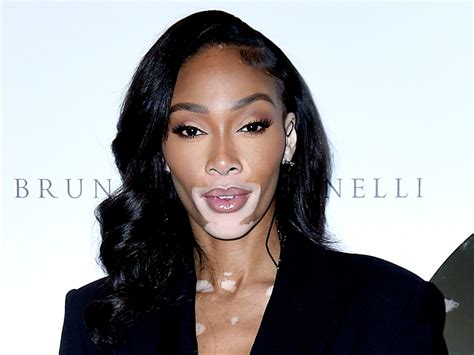 Controversial vitiligo cream with concerning side effects may come to UK | The Independent