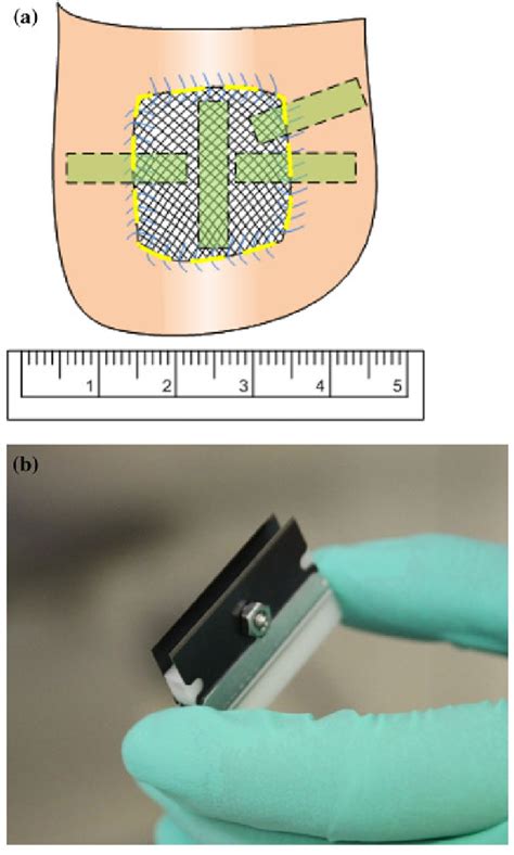Image result for Mutilate Tissue Sample