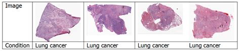 A Survey of Deep Learning for Lung Disease Detection on Medical Images ...