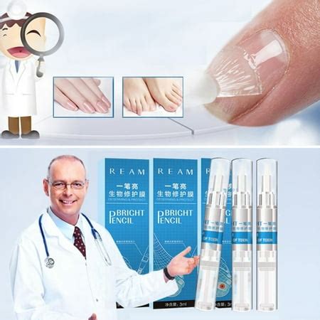 Arishine Fungus Treatment, Fungus Stop, Anti Fungus India | Ubuy