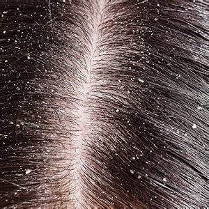 Buy Medisiddh Arugan Thailam 100 Ml | Eczema | Scabies | Fungal ...