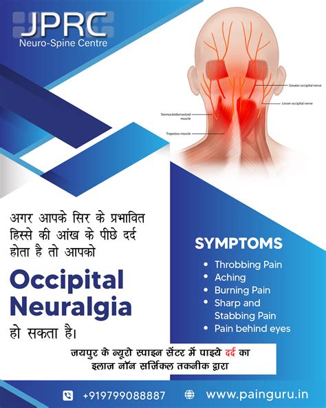Pinched nerve treatment – Artofit