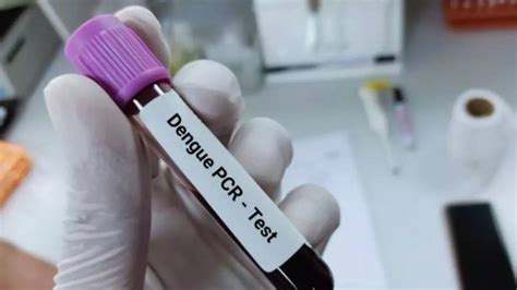 Gurugram Dengue Scare: Health Dept Releases Gambusia Fish To Combat ...