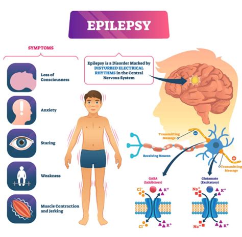 Potential Risks and Side Effects of Deep Brain Stimulation (DBS)