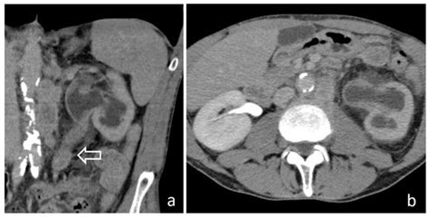 Medicina | Special Issue : Imaging of the Kidney and Urinary Tract