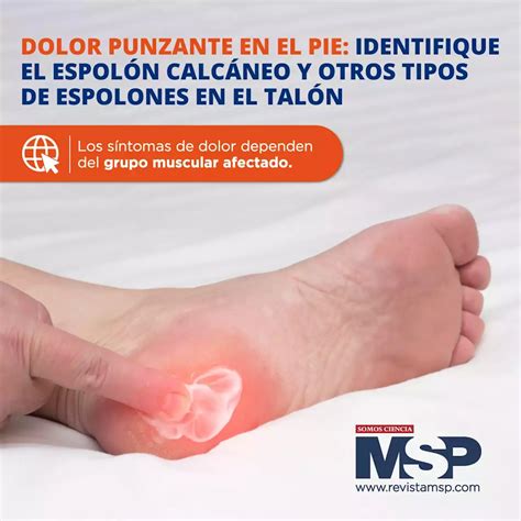 Dolor punzante en el pie: Identifique el espolón calcáneo y otros tipos ...