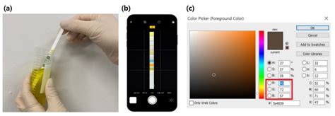 Predictive System Implementation to Improve the Accuracy of Urine Self ...