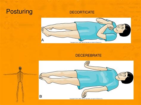 PPT - Chapter 43 PowerPoint Presentation, free download - ID:289906