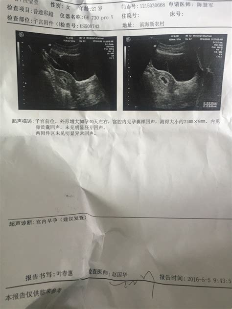 怀孕45天，孕囊3.9×1.4cm,未见胎心和胎牙正常吗？胎囊是不是过大？ - 百度宝宝知道