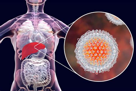 Hepatitis B: Symptoms, Causes, and Treatment