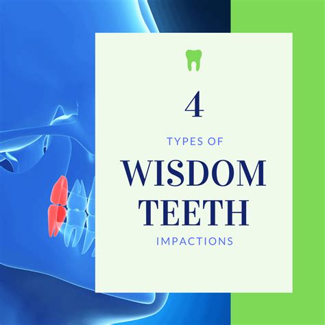 Image result for Wisdom Teeth Impaction Types