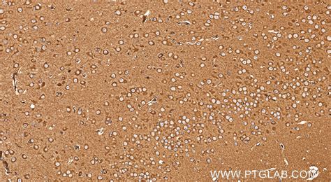DLGAP3 antibody (85695-1-RR) | Proteintech