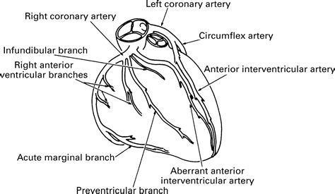 Coronary Artery Branches Anatomy