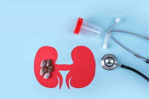 7 Ways to Prevent Kidney Stones | Healthy Türkiye
