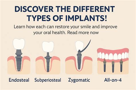 Image result for Different Types of Teeth Implants