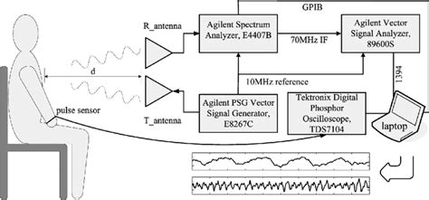 Image result for A Coding VSD Coding