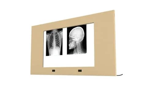 X Ray Viewer for Modular Operation Theatre | WMSPL