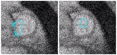 A Level Set-Based Model for Image Segmentation under Geometric ...